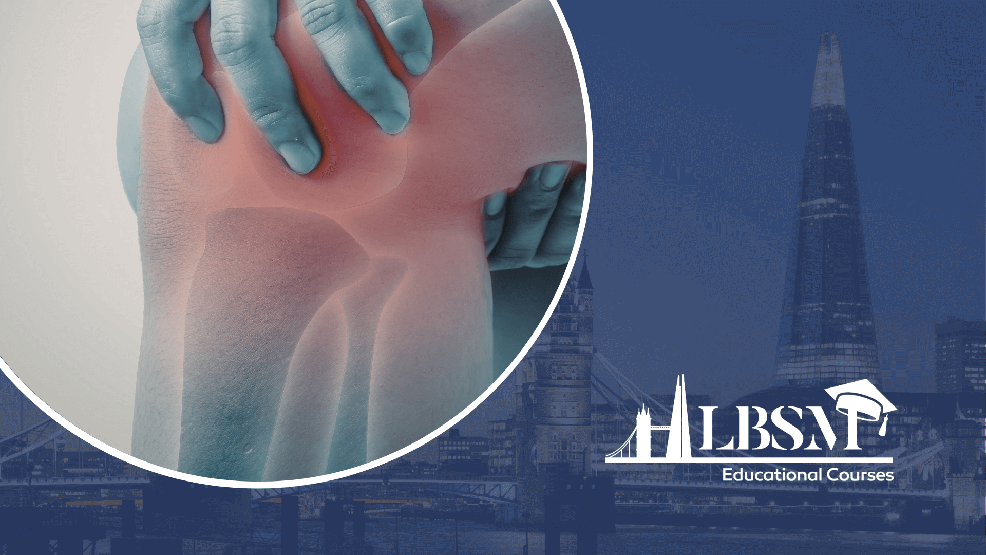Examination of the Knee