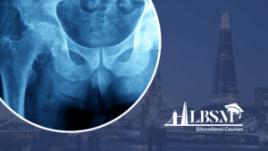 Radiological Investigation of the Hip